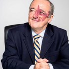r/Damnthatsinteresting - Spanische Wissenschaftler unter der Leitung von MARINO BARBACID haben Bauchspeicheldrüsenkrebs bei Mäusen geheilt. Eine Heilung in Tiermodellen ist ein großer Schritt in Richtung einer potenziellen Krebsbehandlung beim Menschen.
